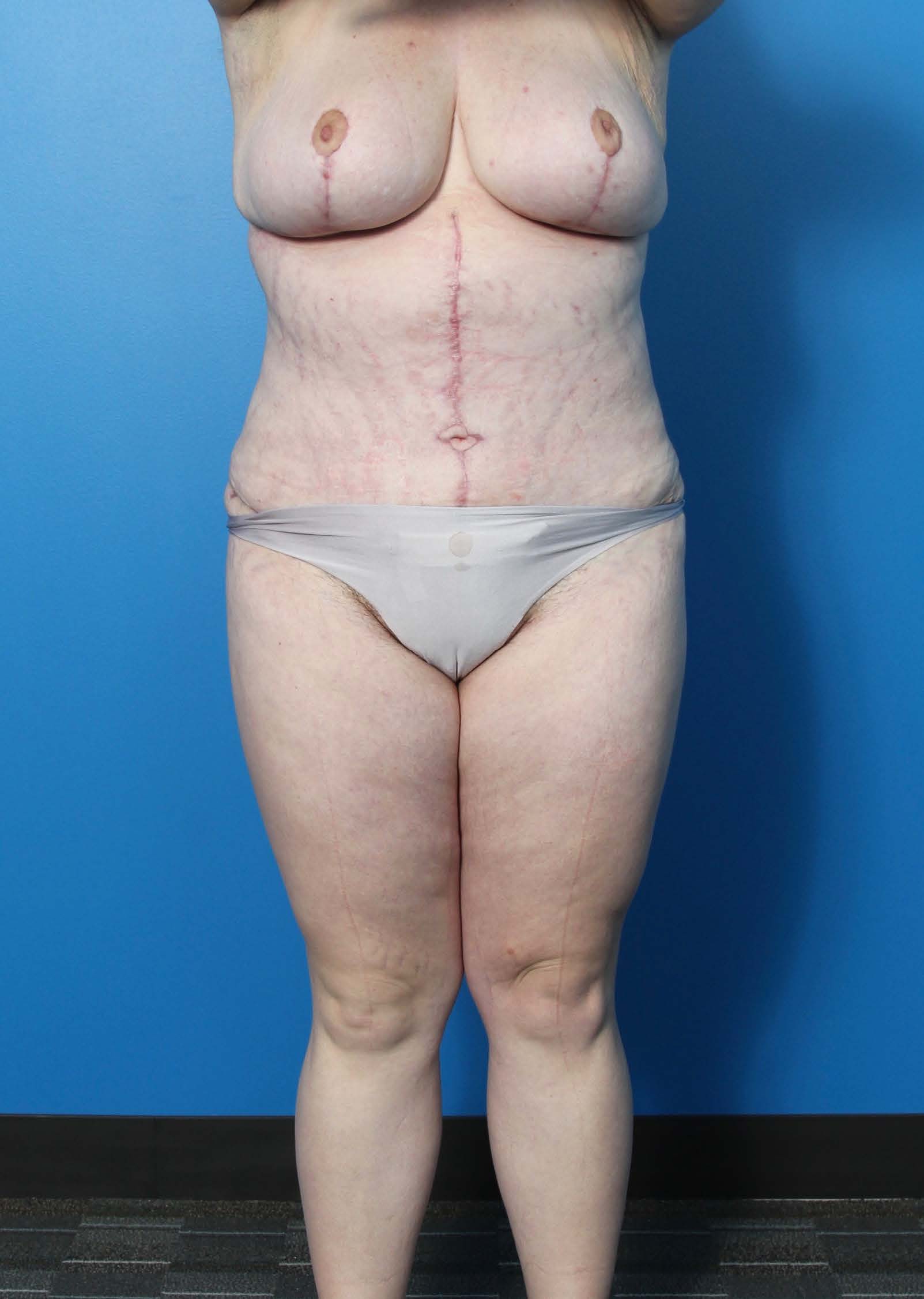 BE MWL 1_Page_1_Image_0002