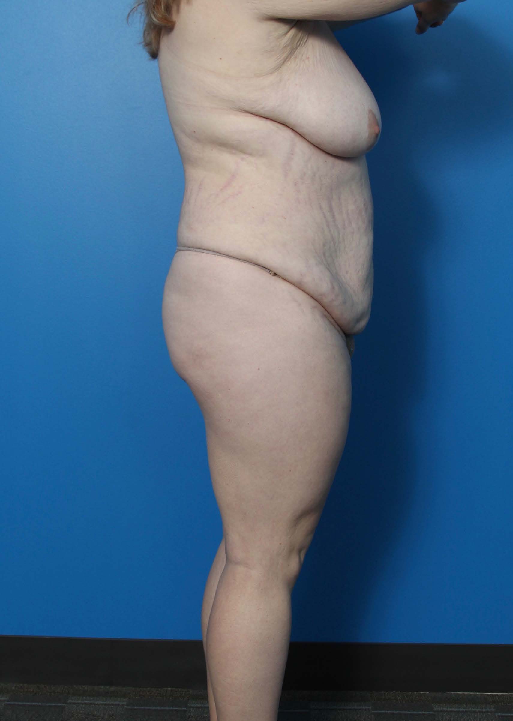 BE MWL 1_Page_1_Image_0003