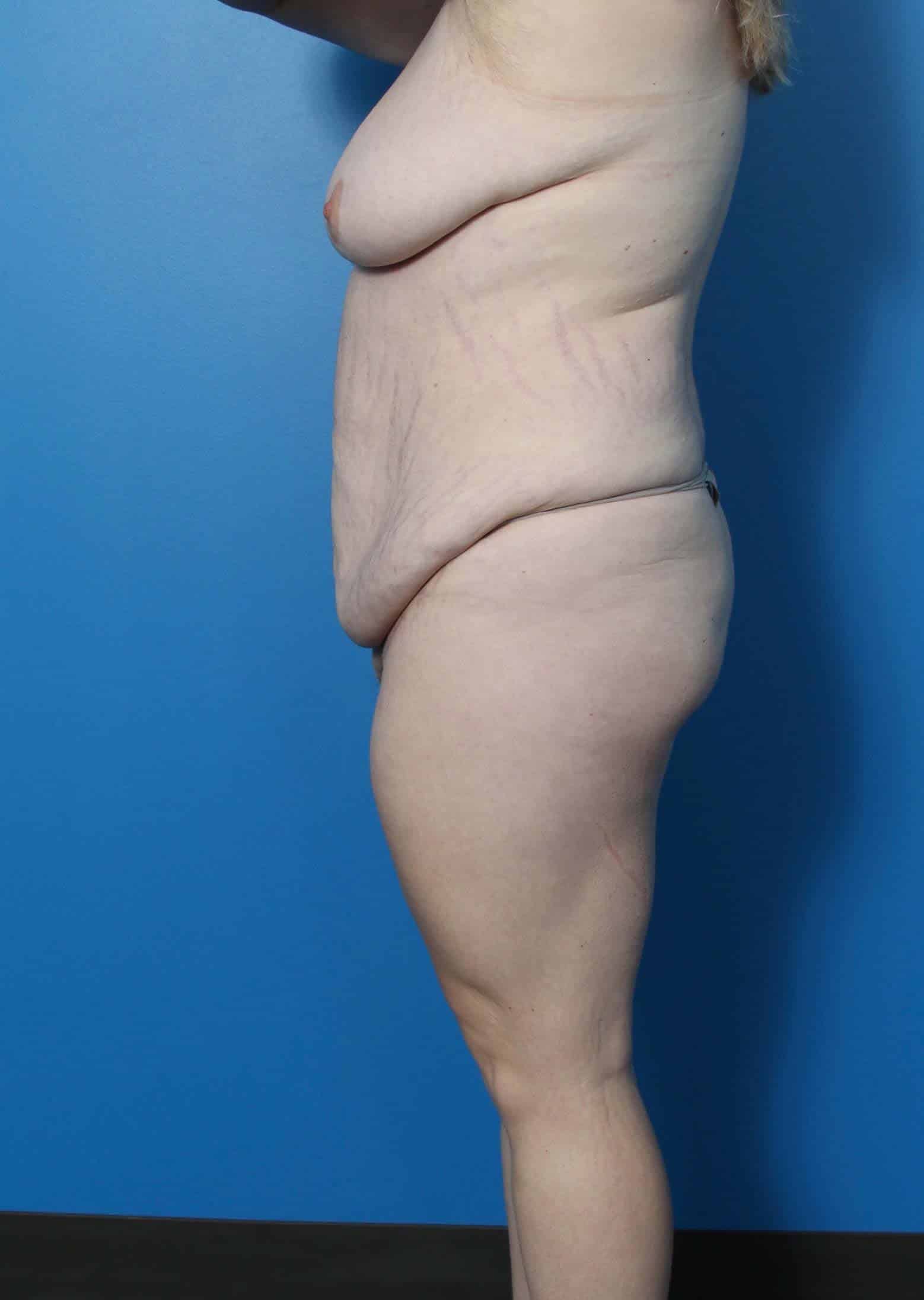 BE MWL 1_Page_2_Image_0001