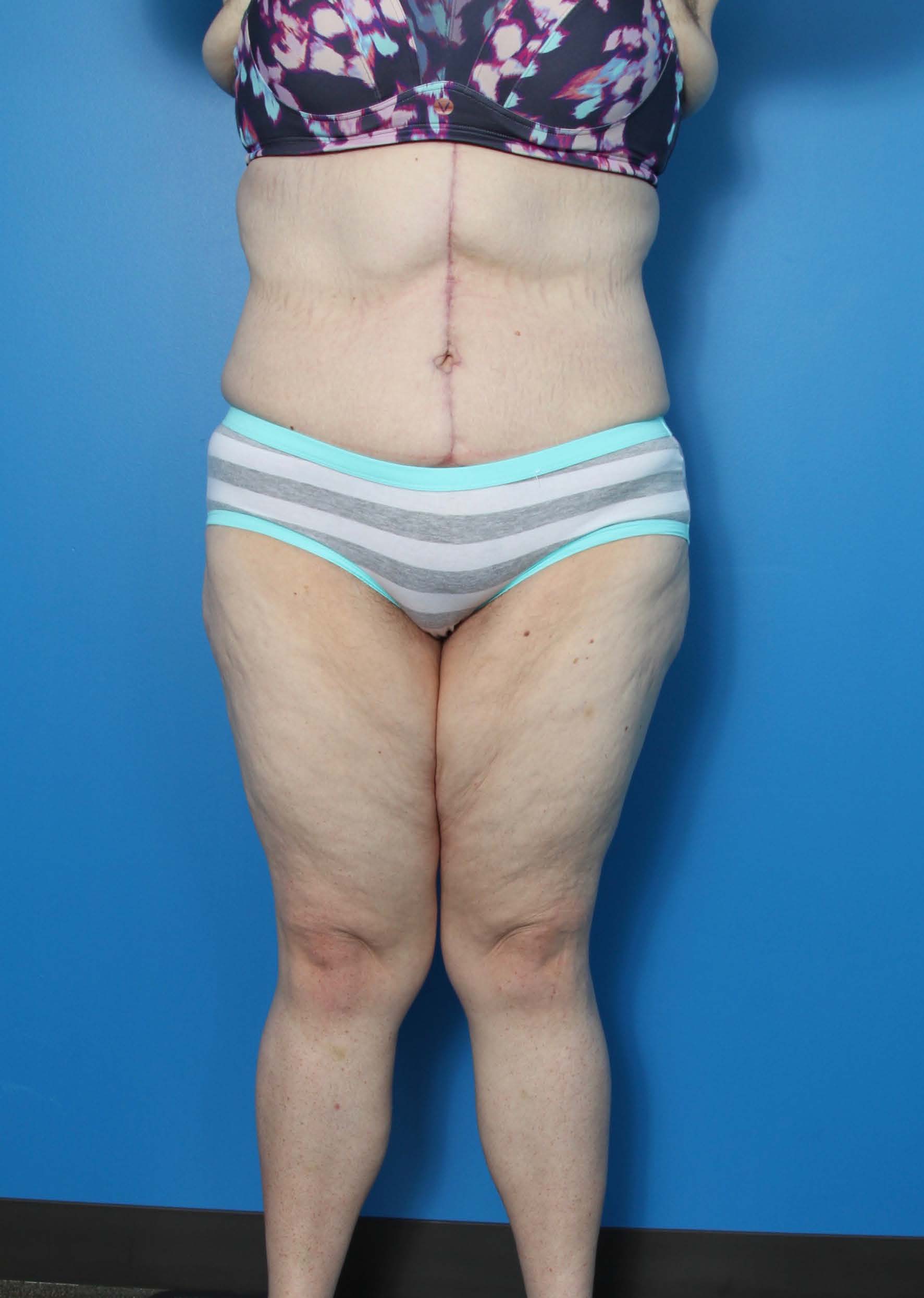 BE MWL 2_Page_1_Image_0002