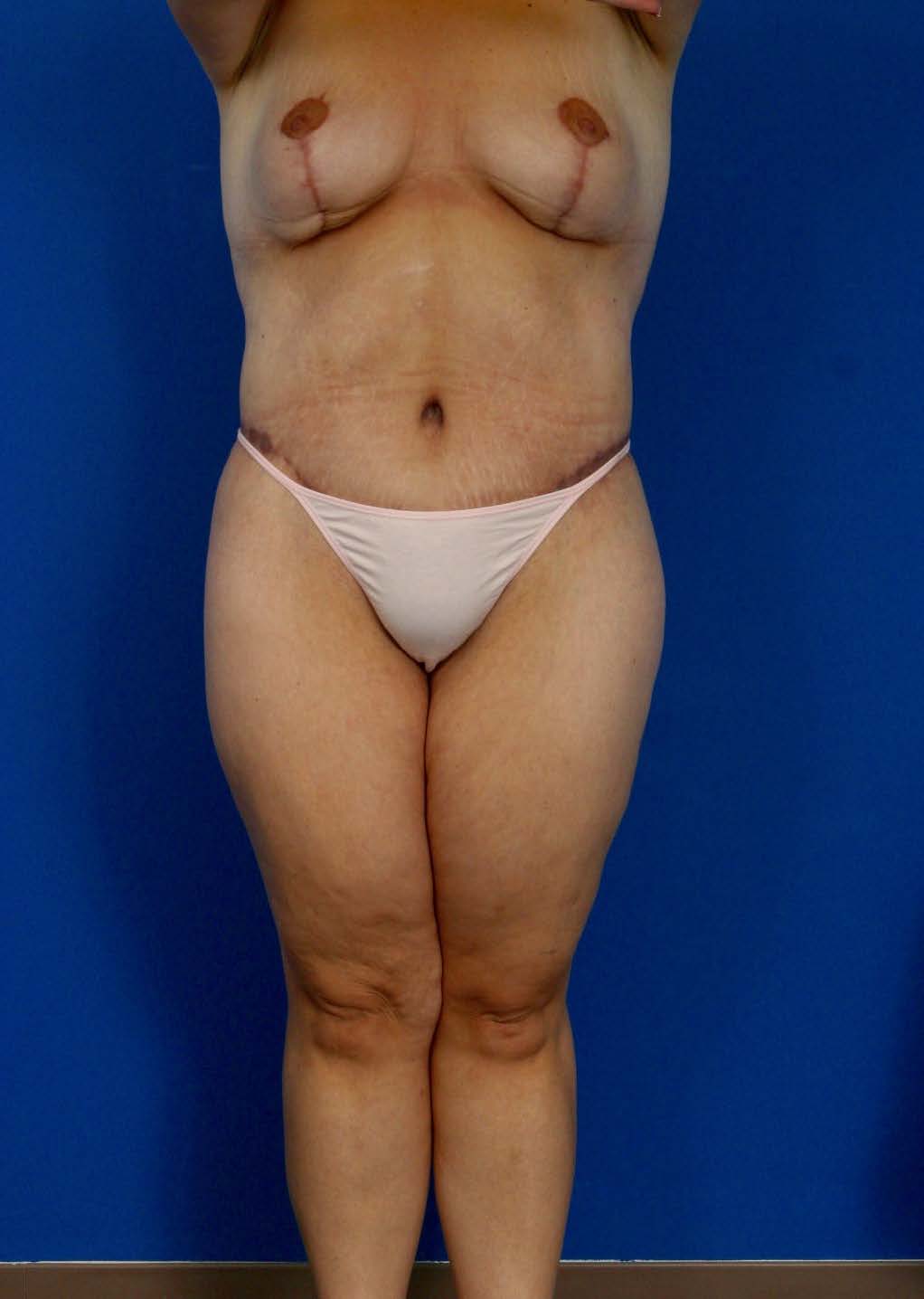 BE MWL 3_Page_1_Image_0002