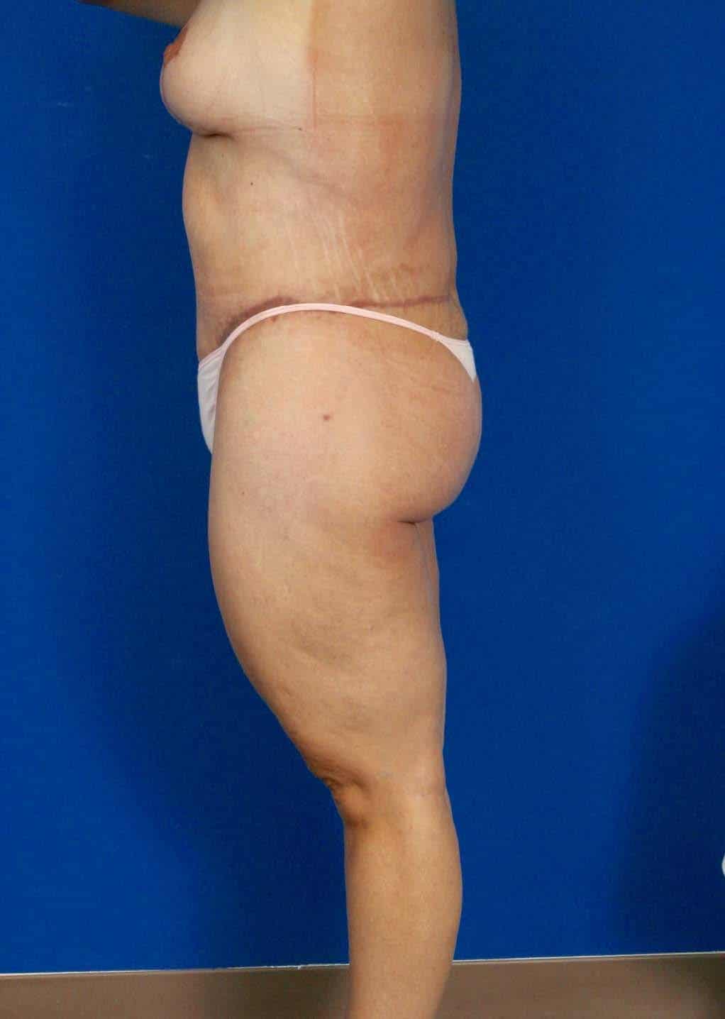 BE MWL 3_Page_1_Image_0004