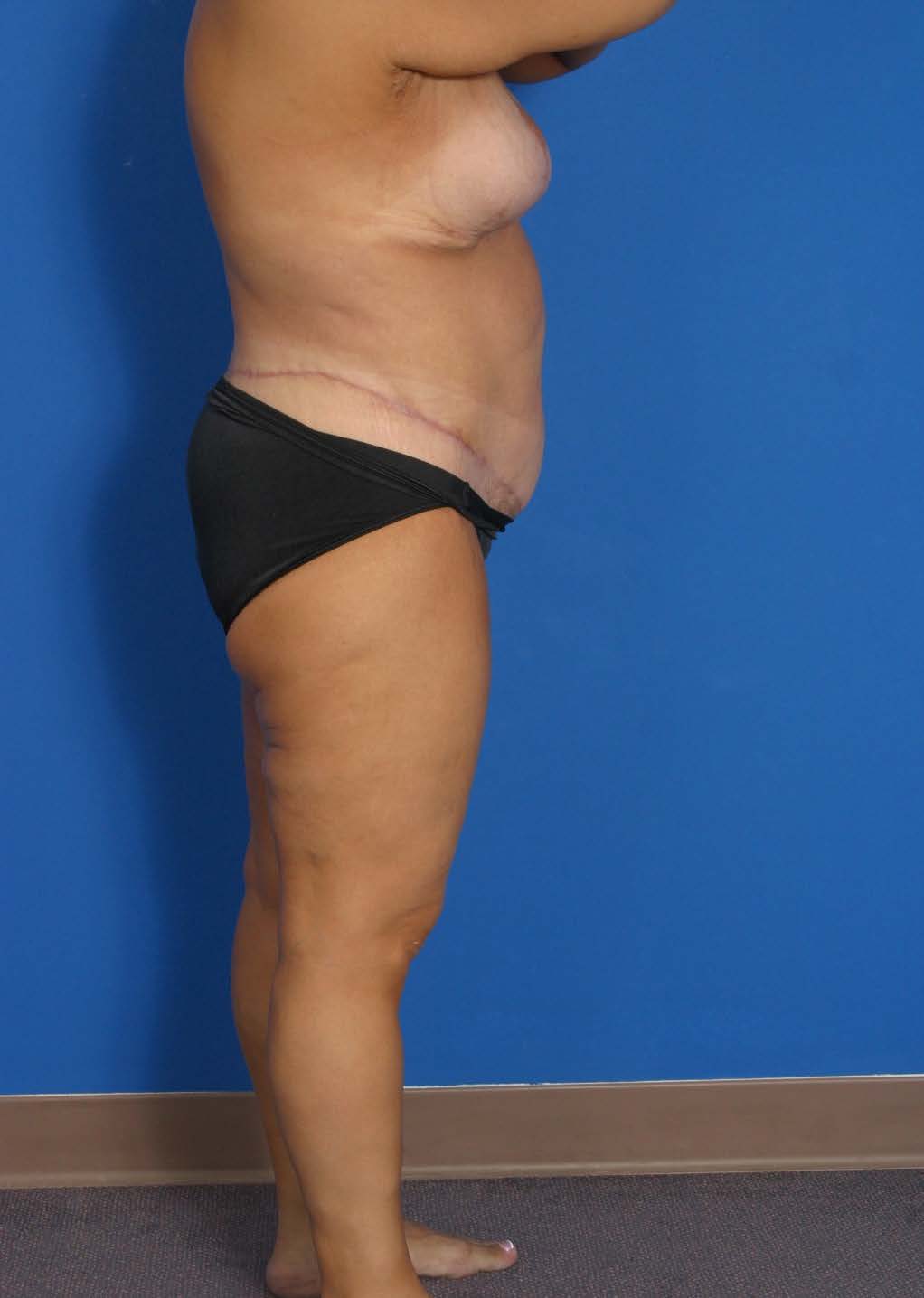 BE MWL 4_Page_2_Image_0002