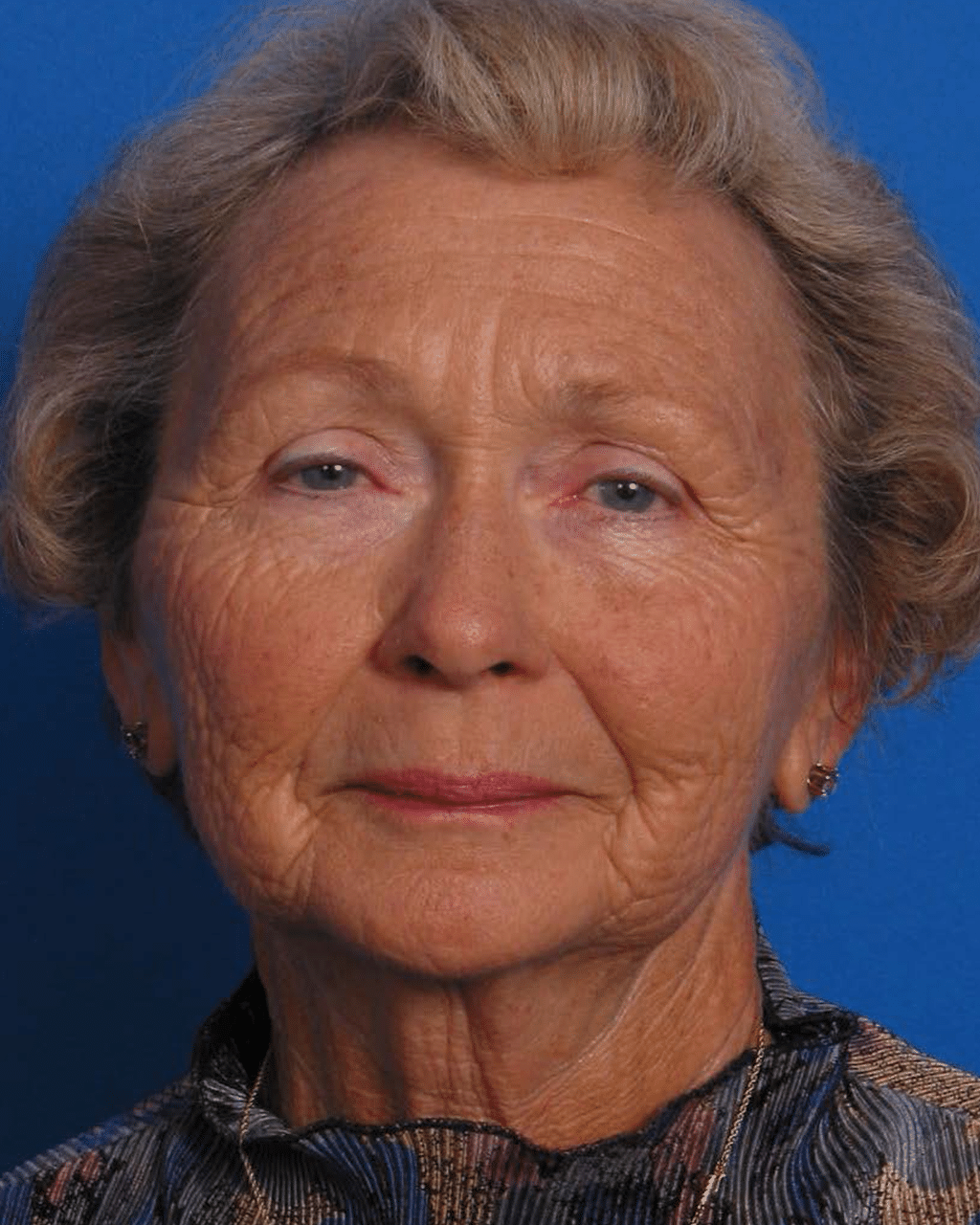 Facial Rej for Book AA_Page_1_Image_0001