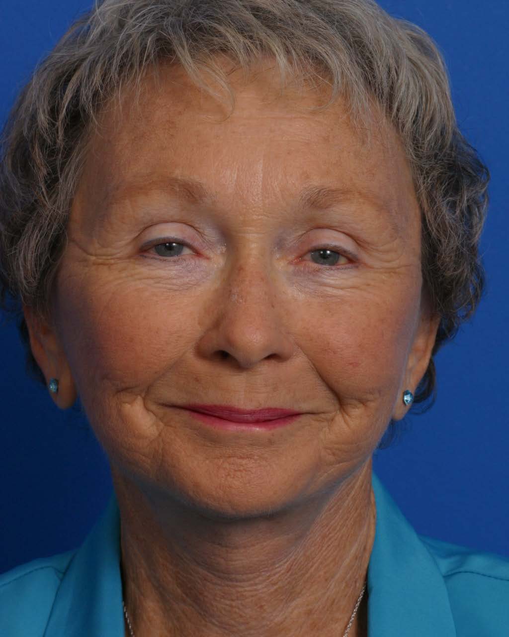 Facial Rej for Book AA_Page_1_Image_0002