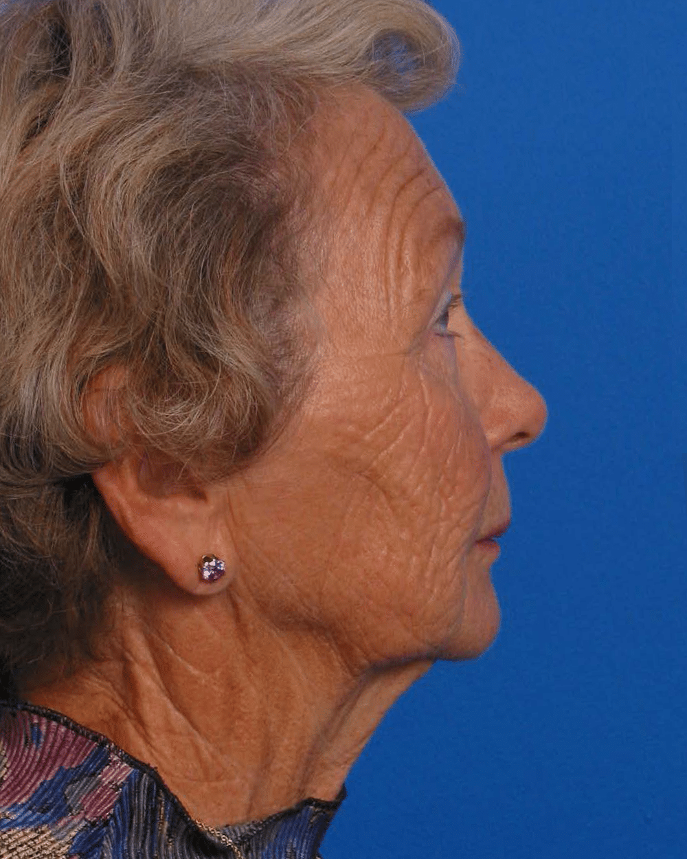 Facial Rej for Book AA_Page_1_Image_0003