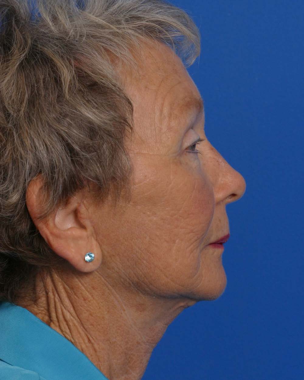 Facial Rej for Book AA_Page_1_Image_0004