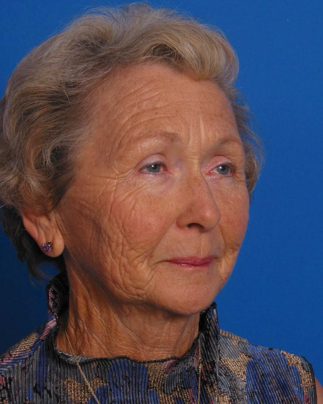 Facial Rej for Book AA_Page_2_Image_0001