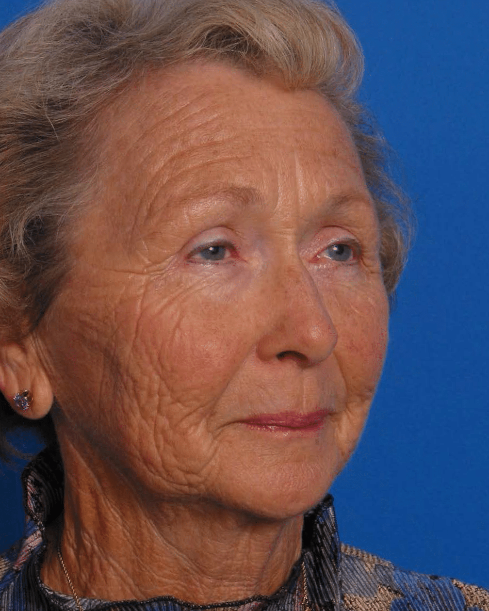 Facial Rej for Book AA_Page_2_Image_0001