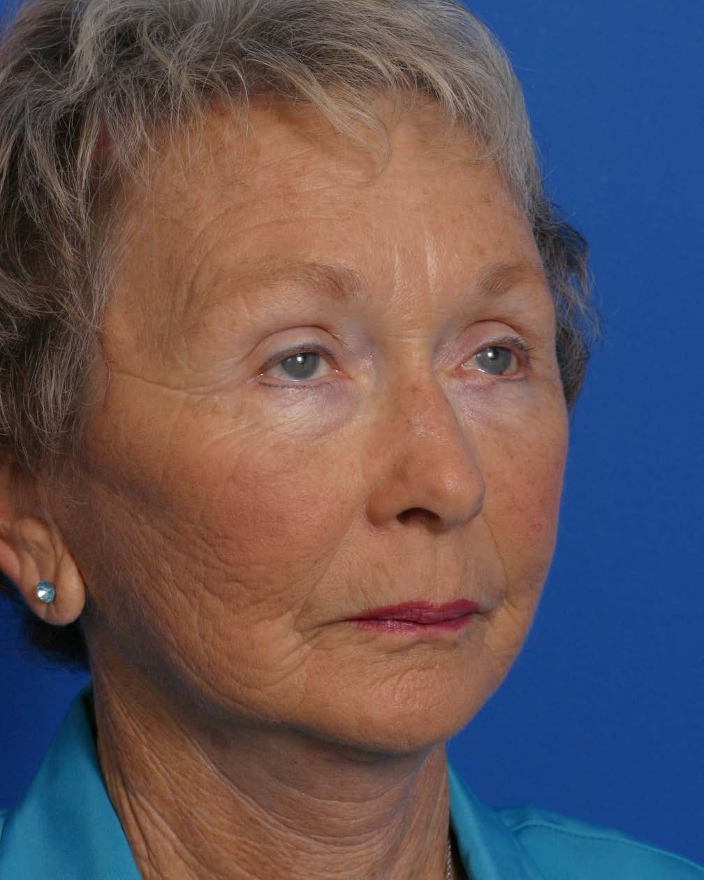 Facial Rej for Book AA_Page_2_Image_0002