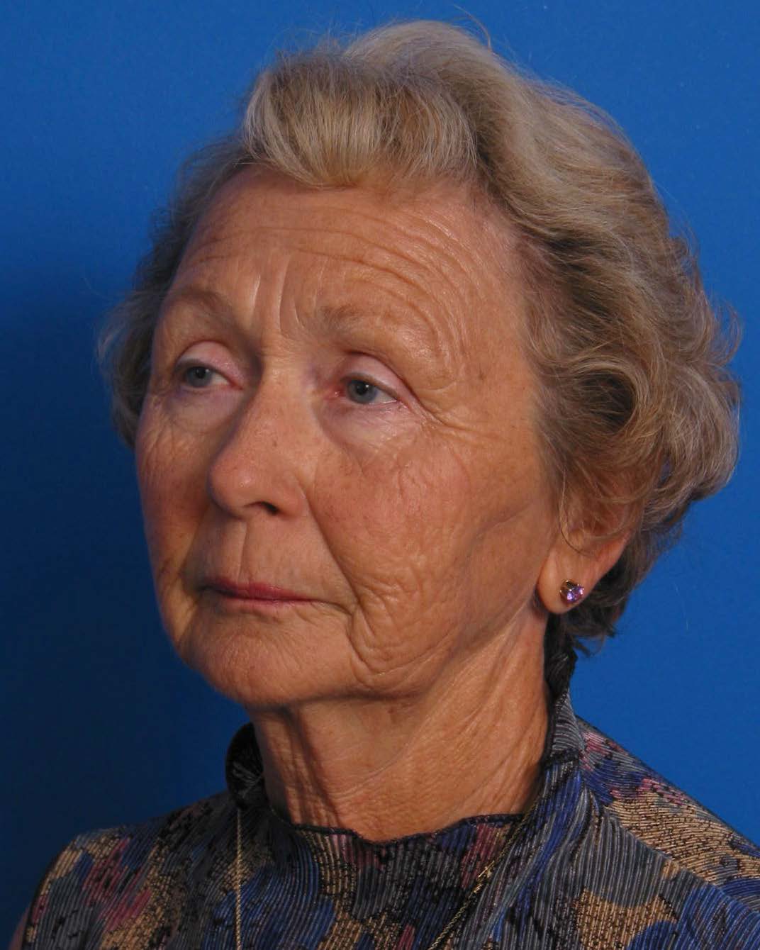 Facial Rej for Book AA_Page_2_Image_0003