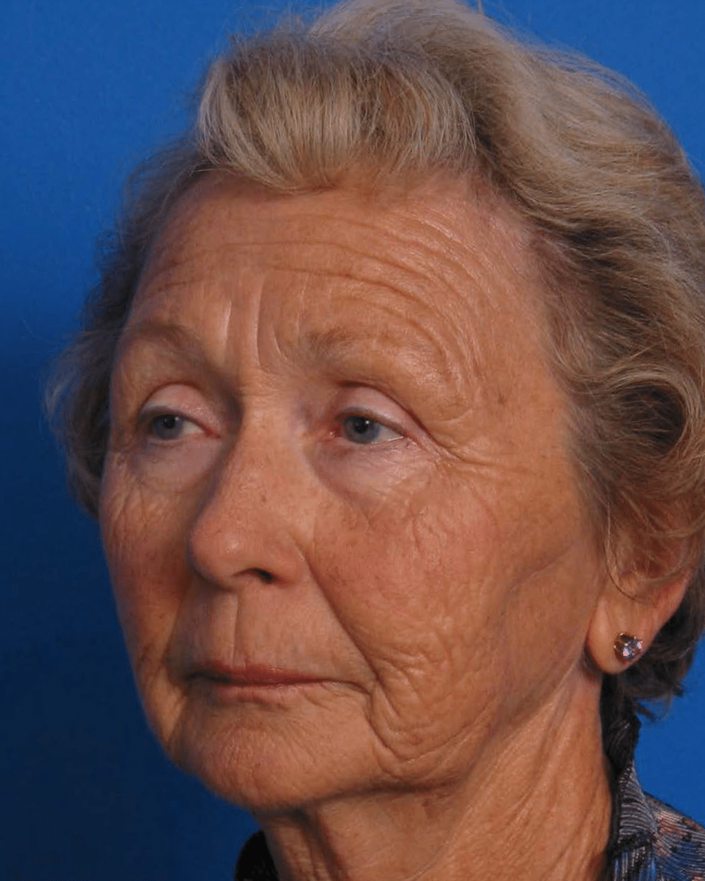 Facial Rej for Book AA_Page_2_Image_0003