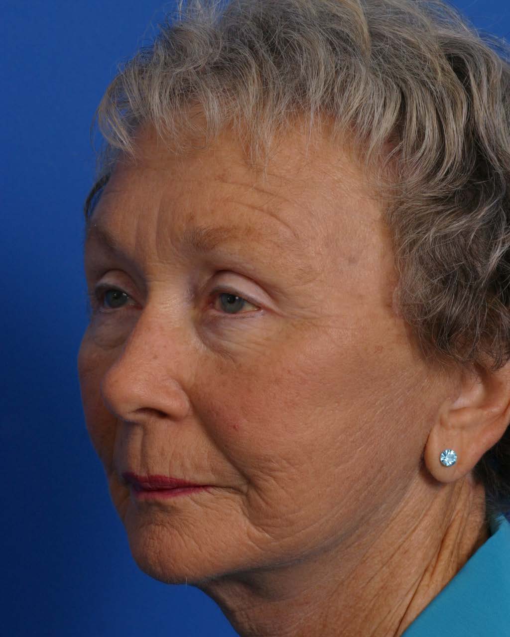 Facial Rej for Book AA_Page_2_Image_0004